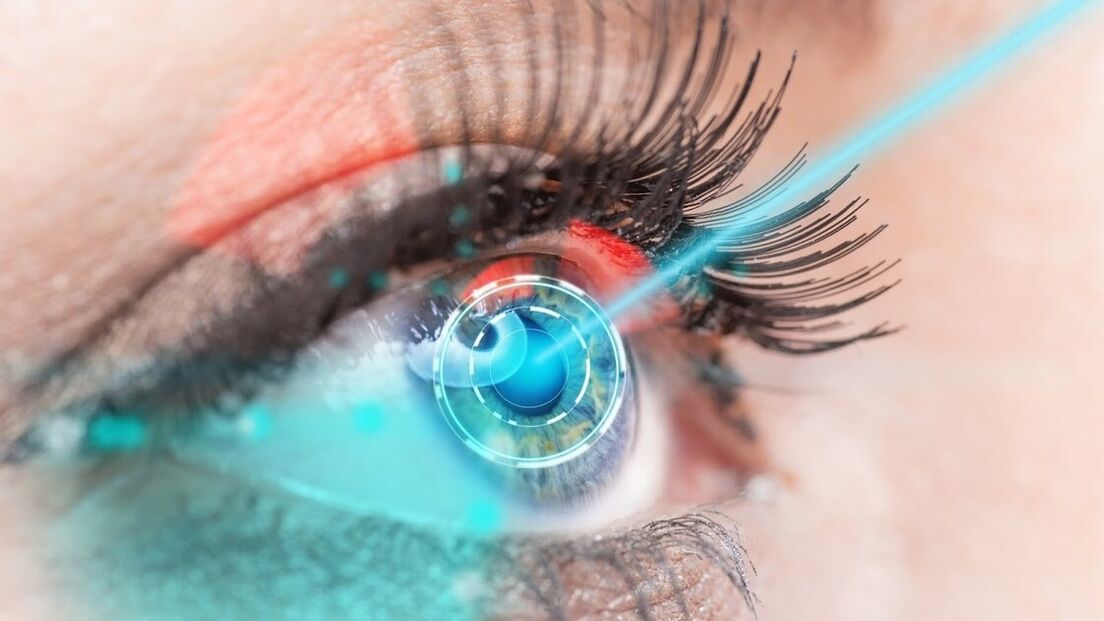 Restoration of vision through laser correction